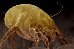 Все про пилові кліщі: як захистити свій будинок з паразитів? Все про пилові кліщі: як захистити свій будинок з паразитів?